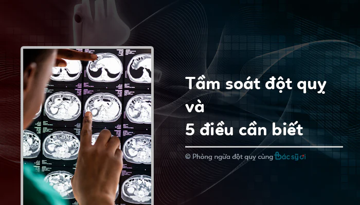 Tầm soát đột quỵ